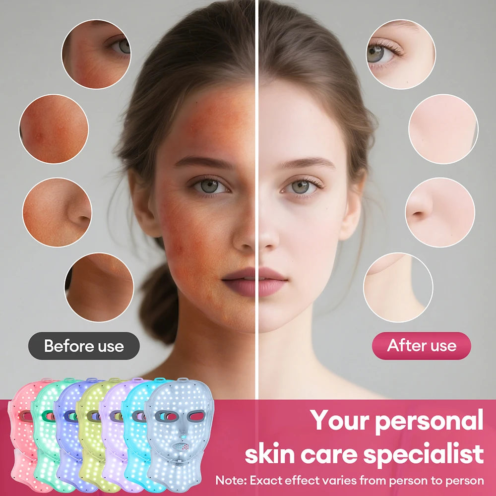 7-Color Light Therapy for Clear, Calm & Radiant Skin